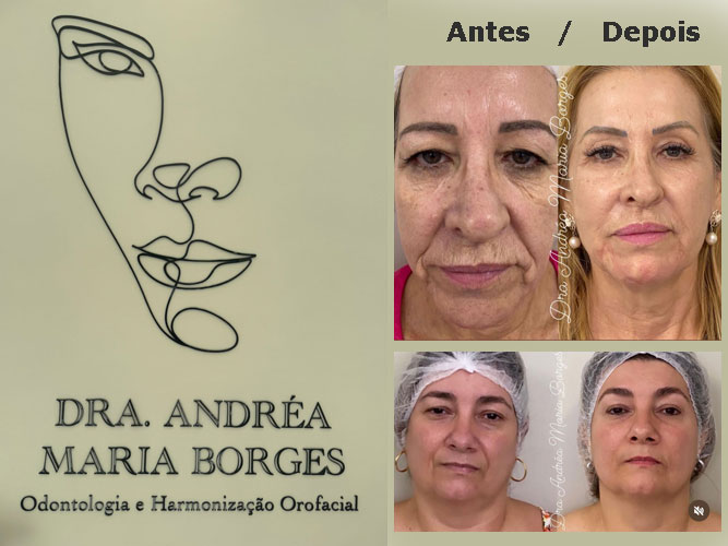 Dra Andréa Borges - Odontologia e Harmonização Orofacial